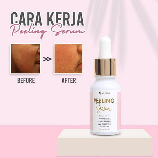 Serum ms glow untuk flek hitam peeling serum