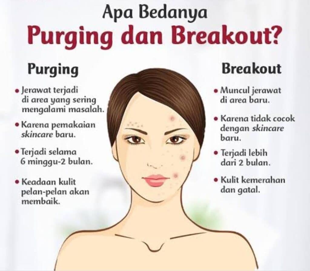 Perbedaan purging dan breakout